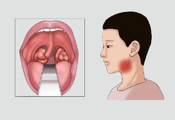 白叟春季摄生护心是关键 保健防病守四关键